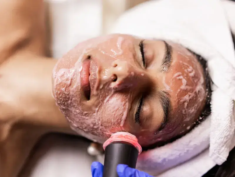 facial treatments